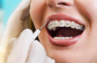 How High-End Orthodontic Care Enhances Lifestyle and Confidence